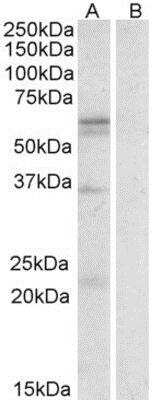 Western Blot: SLC7A5/LAT1 Antibody [NBP1-51935]