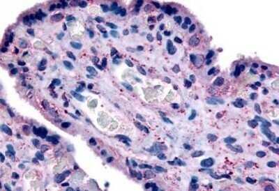 Immunohistochemistry-Paraffin: SLC7A5/LAT1 Antibody - BSA Free [NB110-39038]