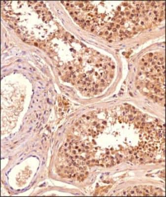 Immunohistochemistry-Paraffin: SLC7A5/LAT1 Antibody (BU53) - BSA Free [NBP2-50465]