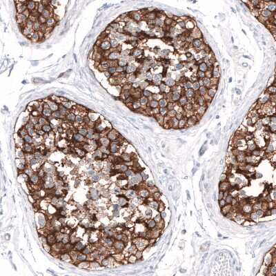 Immunohistochemistry-Paraffin: SLC7A5/LAT1 Antibody [NBP2-33662]