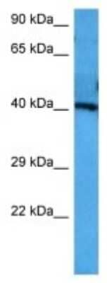 Western Blot: SLC7A5/LAT1 Antibody [NBP3-09988]