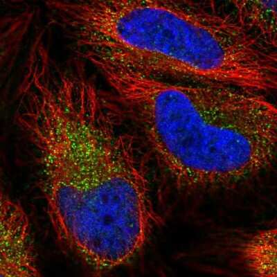 Immunocytochemistry/ Immunofluorescence: SLC7A6 Antibody [NBP2-30868]