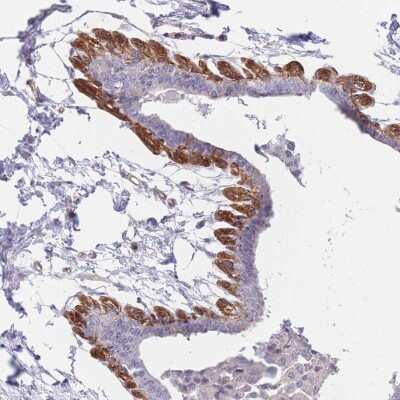Immunohistochemistry-Paraffin: SLC7A6 Antibody [NBP2-30868]