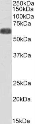 Western Blot: SLC7A6 Antibody [NBP2-75086]