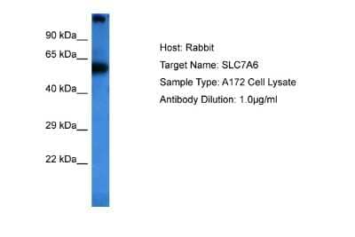 Western Blot: SLC7A6 Antibody [NBP2-85766]