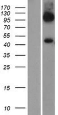 Western Blot: SLC7A6 Overexpression Lysate [NBP2-07929]