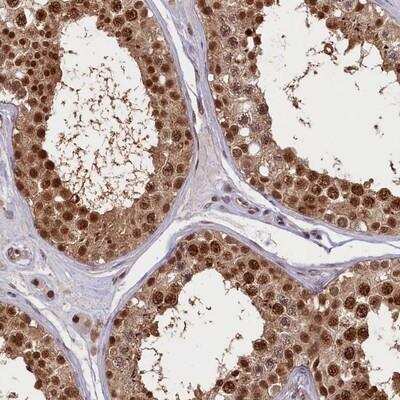 Immunohistochemistry-Paraffin: SLC7A6OS Antibody [NBP1-82260]