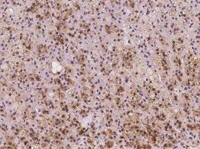 Immunohistochemistry-Paraffin: SLC7A6OS Antibody [NBP3-05945]