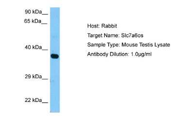 Western Blot: SLC7A6OS Antibody [NBP2-83557]