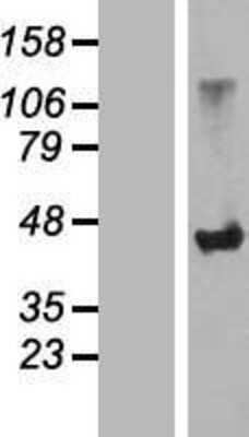 Western Blot: SLC7A6OS Overexpression Lysate [NBL1-16190]