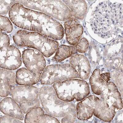 Immunohistochemistry-Paraffin: SLC7A7 Antibody [NBP1-82826]