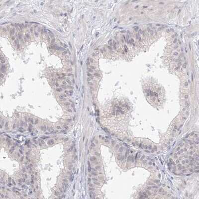 Immunohistochemistry-Paraffin: SLC7A7 Antibody [NBP1-82826]