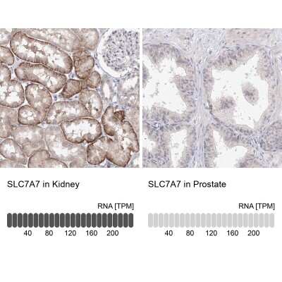 Immunohistochemistry-Paraffin: SLC7A7 Antibody [NBP1-82826]