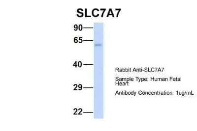 Western Blot: SLC7A7 Antibody [NBP1-59856]