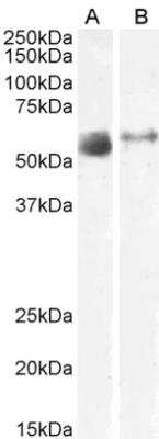 Western Blot: SLC7A7 Antibody [NBP2-75085]