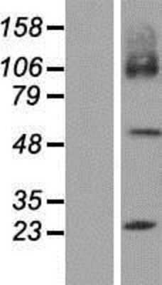 Western Blot: SLC7A7 Overexpression Lysate [NBP2-07928]