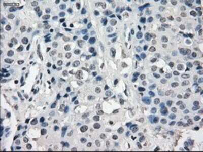 Immunohistochemistry-Paraffin: SLC7A8 Antibody (OTI7D6) [NBP1-47989]