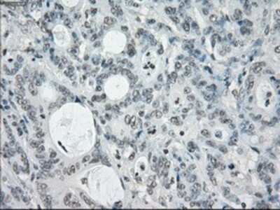 Immunohistochemistry-Paraffin: SLC7A8 Antibody (OTI7D6) [NBP1-47989]