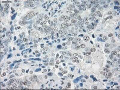 Immunohistochemistry-Paraffin: SLC7A8 Antibody (OTI7D6) [NBP1-47989]