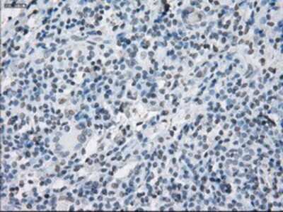 Immunohistochemistry-Paraffin: SLC7A8 Antibody (OTI7D6) [NBP1-47989]