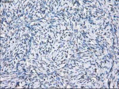 Immunohistochemistry-Paraffin: SLC7A8 Antibody (OTI7D6) [NBP1-47989]