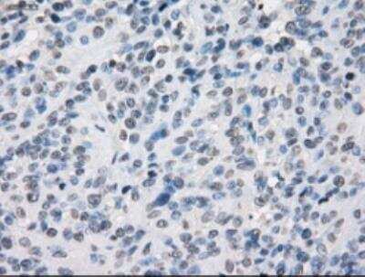 Immunohistochemistry-Paraffin: SLC7A8 Antibody (OTI7D6) [NBP1-47989]