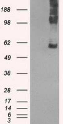 Western Blot: SLC7A8 Antibody (OTI7D6) [NBP1-47989]