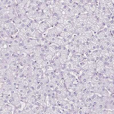 Immunohistochemistry-Paraffin: SLC7A8 Antibody [NBP2-49026]