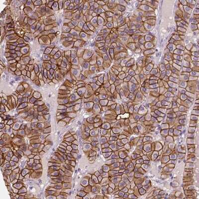 Immunohistochemistry-Paraffin: SLC7A8 Antibody [NBP2-49319]