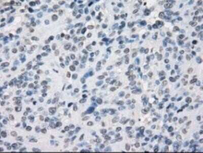 Immunohistochemistry: SLC7A8 Antibody (OTI7D6) - Azide and BSA Free [NBP2-74215]