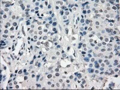 Immunohistochemistry: SLC7A8 Antibody (OTI7D6) - Azide and BSA Free [NBP2-74215]