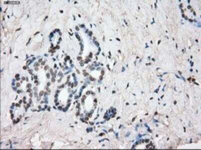 Immunohistochemistry: SLC7A8 Antibody (OTI7D6) - Azide and BSA Free [NBP2-74215]