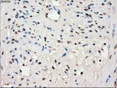 Immunohistochemistry: SLC7A8 Antibody (OTI7D6) - Azide and BSA Free [NBP2-74215]