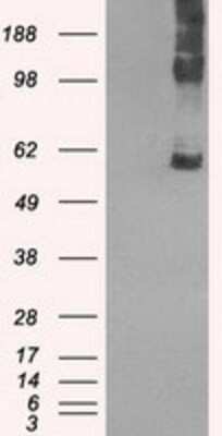 Western Blot: SLC7A8 Antibody (OTI7D6)Azide and BSA Free [NBP2-74215]