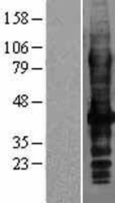 Western Blot: SLC7A8 Overexpression Lysate [NBP2-04330]