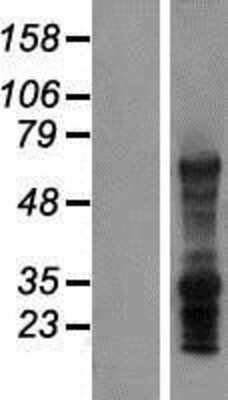 Western Blot: SLC7A8 Overexpression Lysate [NBP2-04821]