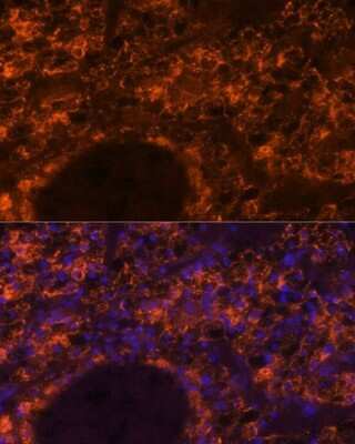 Immunohistochemistry: SLC7A9 Antibody - Azide and BSA Free [NBP2-93638]