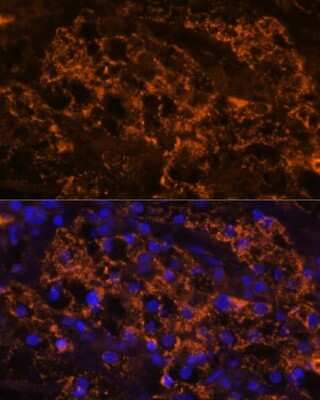 Immunohistochemistry: SLC7A9 Antibody - Azide and BSA Free [NBP2-93638]