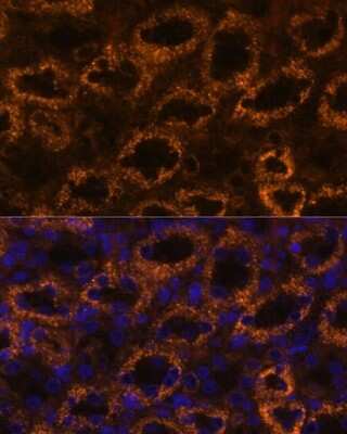 Immunohistochemistry: SLC7A9 Antibody - Azide and BSA Free [NBP2-93638]