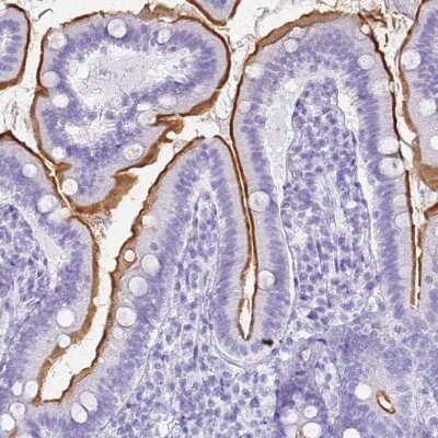 Immunohistochemistry-Paraffin: SLC7A9 Antibody [NBP1-92409]