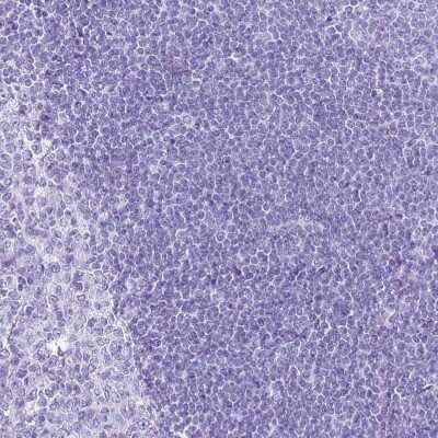 Immunohistochemistry-Paraffin: SLC7A9 Antibody [NBP1-92409]
