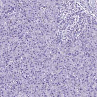 Immunohistochemistry-Paraffin: SLC7A9 Antibody [NBP1-92409]