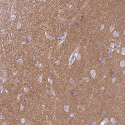 Immunohistochemistry-Paraffin: SLC8A2 Antibody [NBP2-48980]