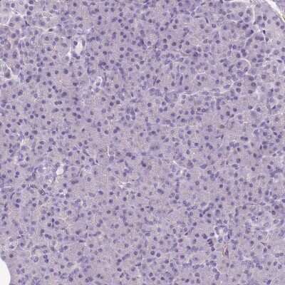 Immunohistochemistry-Paraffin: SLC8A2 Antibody [NBP2-48980]