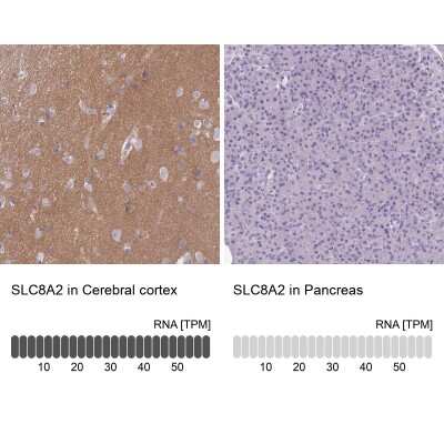 Immunohistochemistry-Paraffin: SLC8A2 Antibody [NBP2-48980]