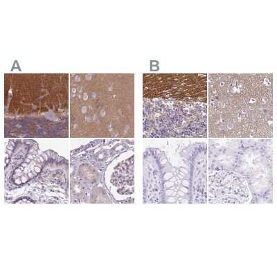 Immunohistochemistry-Paraffin: SLC8A2 Antibody [NBP2-48980]