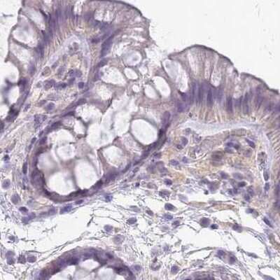 Immunohistochemistry-Paraffin: SLC8A2 Antibody [NBP2-48980]