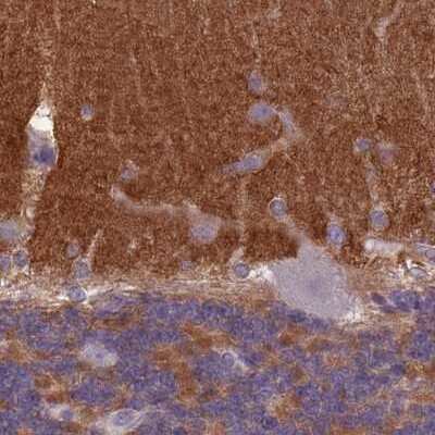 Immunohistochemistry-Paraffin: SLC8A2 Antibody [NBP2-48980]