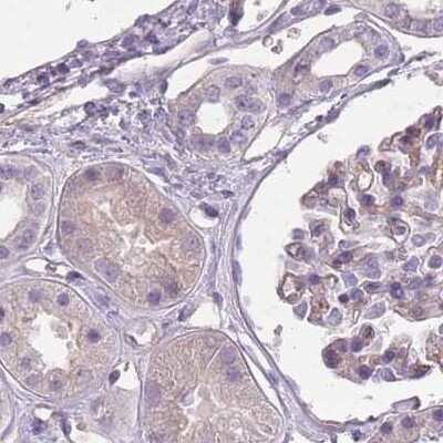 Immunohistochemistry-Paraffin: SLC8A2 Antibody [NBP2-48980]
