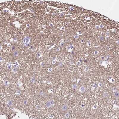 Immunohistochemistry-Paraffin: SLC8A2 Antibody [NBP2-49145]